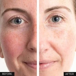 Avon Cosmetics Anew Renewal Protinol Power Serum Top Rated