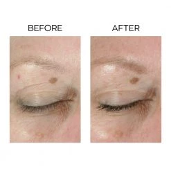 Top Rated Anew Lifting Dual Eye System